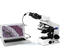 高分辨率清晰显微镜CCD成像系统