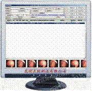 肛肠镜影像系统工作站