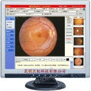 眼科影像系统工作站