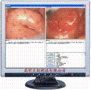 阴道镜影像系统工作站